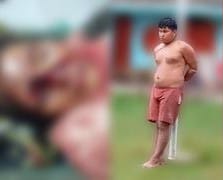 Mulher perdeu o olho direito devido a tentativa de feminicídio do ex-companheiro em Loreto no Peru