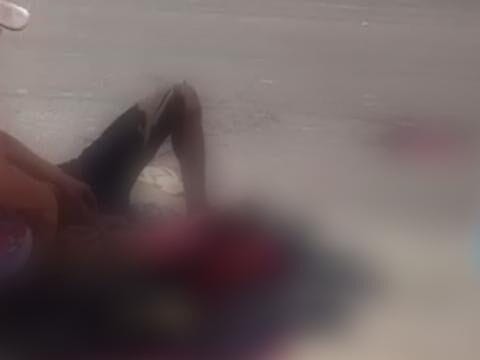 Caminhão Atropela Pedestre e Esmaga Sua Perna na BR-343