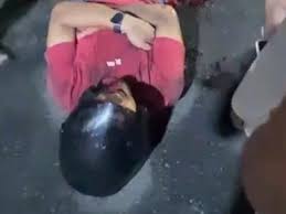 Jovem sofre grave acidente de moto em Santa Cruz do Capibaribe-PE