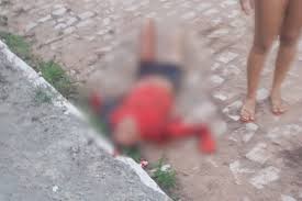 Homem perde os braços após ataque de pitbulls na Grande Natal