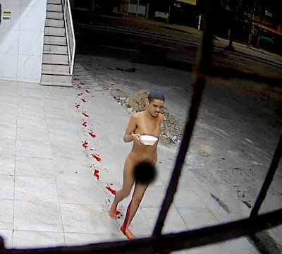 Andando na rua peladão após ser esfaqueado nas costas no bairro Aerolândia, no Ceará