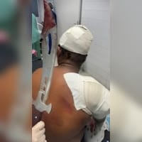 Homem chega ao hospital com espada cravada no ombro