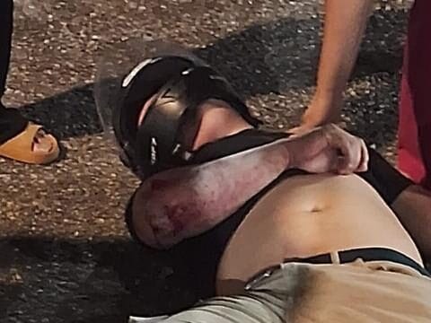 Motociclista sofre acidente grave e tem pé dilacerado em queda em Belém, no Pará