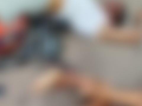 Acidente entre moto e carreta deixa casal gravemente ferido em Tailândia, Pará