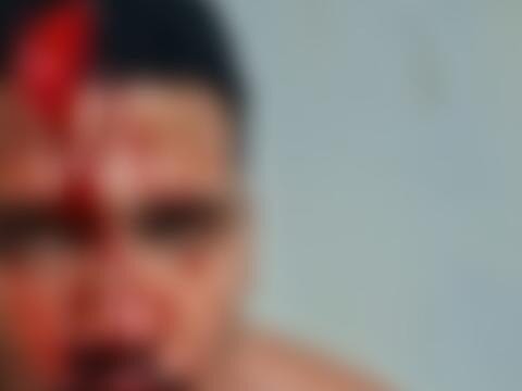 Homem é atacado com facão por vizinho após discussão por som alto em Ilhéus (BA)