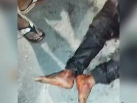 Homem é encontrado ferido com sinais de tortura em rua de Nova Iguaçu