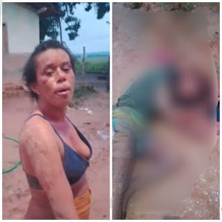 Mulher esfaqueia homem durante briga em bebedeira na zona rural de Rio Largo