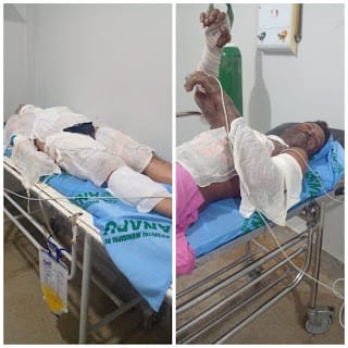 Homem e mulher ficam gravemente feridos após ataque com substância inflamável em Anapur, no Pará