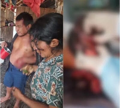 Cacique sofre grave ferimento na cabeça após ser atacado por onça em Lábrea (AM)