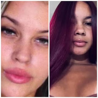 Duas jovens morrem em grave acidente de moto em Nova Iguaçu