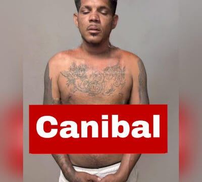 Homem morde e arranca parte dos lábios da namorada em São Luís