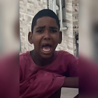 FOTOS: Adolescente tem a rolinha arrancada por pitbull ao tentar pular muro em Santaluz, Bahia