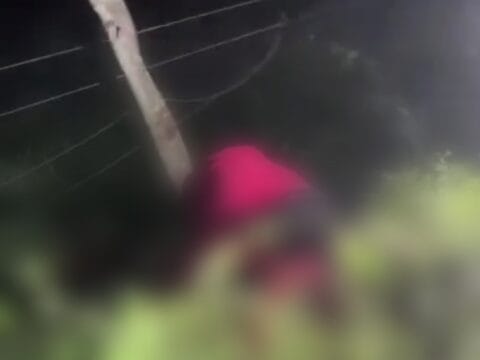 Adolescente de 15 anos sofre acidente de moto e tem o rosto desfigurado