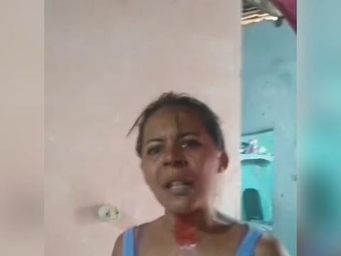 Mulher agride a própria irmã após descobrir caso com seu companheiro