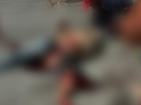 Homem tem perna esmagada após atropelamento; vídeo circula nas redes