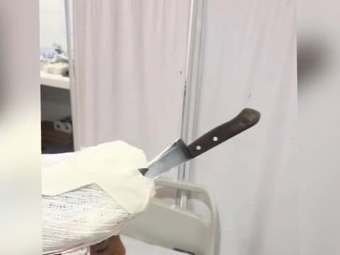 Adolescente fica com faca cravada na cabeça após briga com irmão mais novo no Marajó (PA)