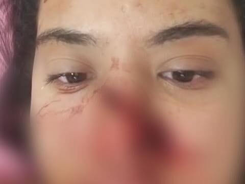 Jovem grava vídeo gravemente ferida após tentativa de estupro em Condado, na Zona da Mata de Pernambuco