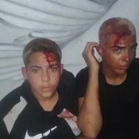 Ladrões são obrigados a beijar de língua após serem pegos roubando em São João de Meriti (RJ)
